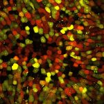 Confetti liver cells stained with red, yellow and green fluorescent proteins (RFP, YFP and GFP)