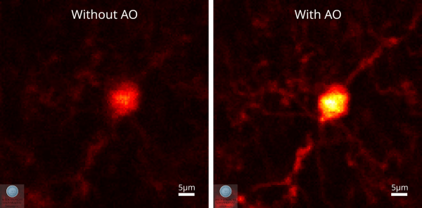 Upgrade of a two-photon microscope for deep tissue imaging of single neurons in a mouse brain. 